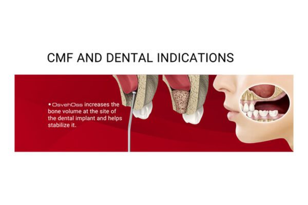 CMF and DEntal indications